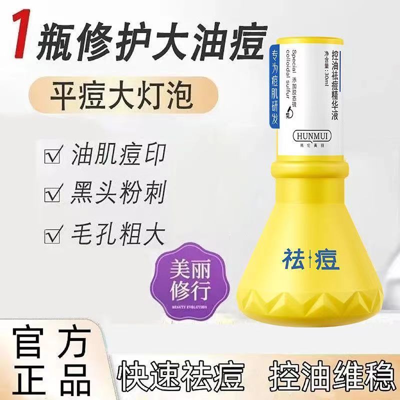 祛痘大灯泡正品精华补水改善祛痘坑祛红痘印黑头粉刺素温和不刺激
