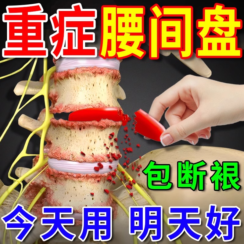 北京同仁堂腰间盘突出专用药压迫神经腰疼腿麻屁股疼腰肌劳损贴膏