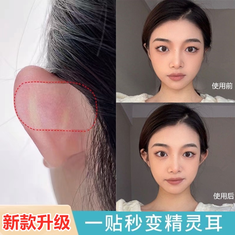 精灵耳贴定型透明隐形立耳贴耳朵支撑器大脸显小贴面耳神器可水洗