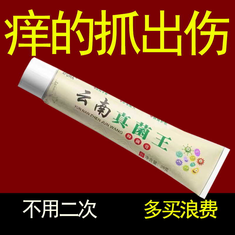 【老奶奶的方子】苗家祖方云南真菌王外用止痒抑菌乳膏草本涂抹软