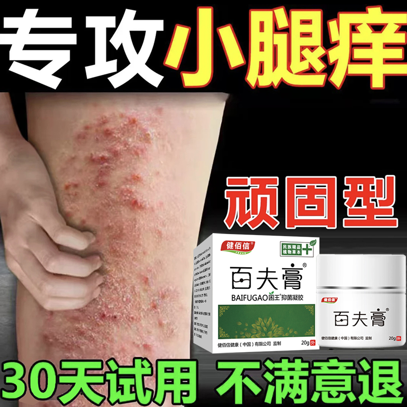 腿上皮肤干燥发痒小腿皮肤痒秋冬天腿上很痒越抓越痒止痒膏草本