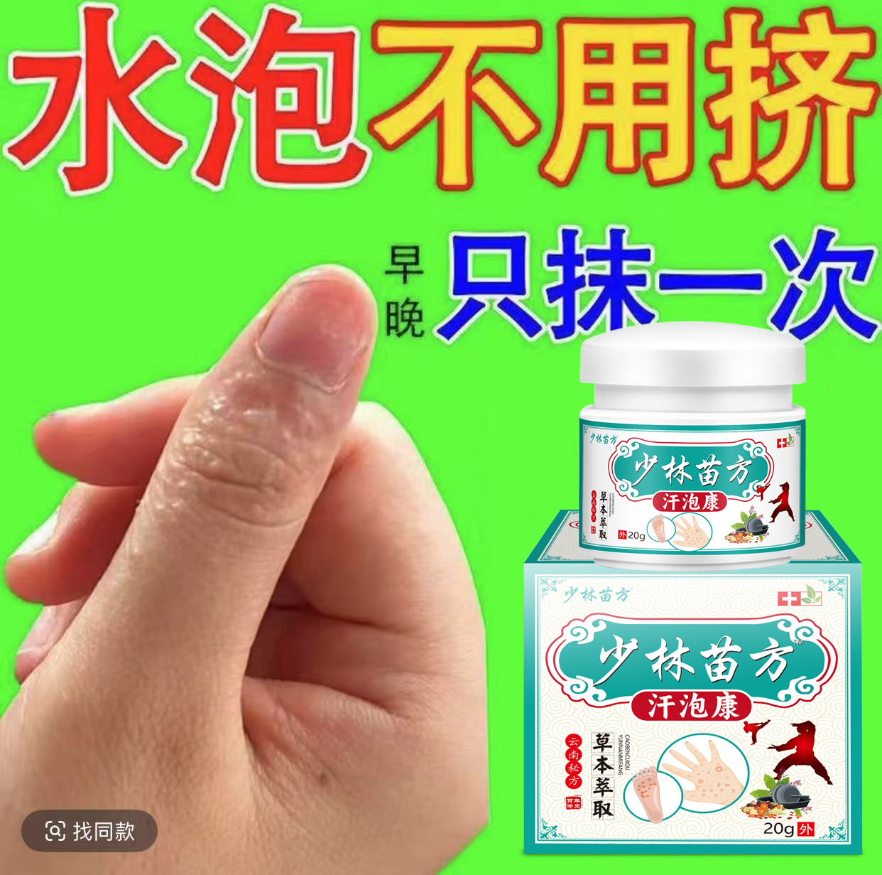 汗泡诊克星手上起小水泡止痒膏脱皮抑菌手指缝痒干裂专用草本乳膏