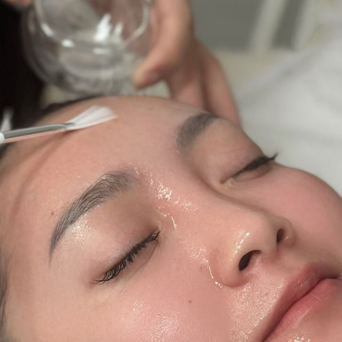 【瑞士院线升级三合一】水光+酶疗紧致透亮细腻水光蛋白酶液 5ml