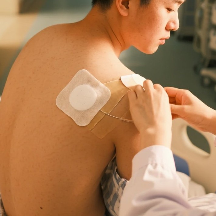 泗水砭石疗养院三伏穴位板