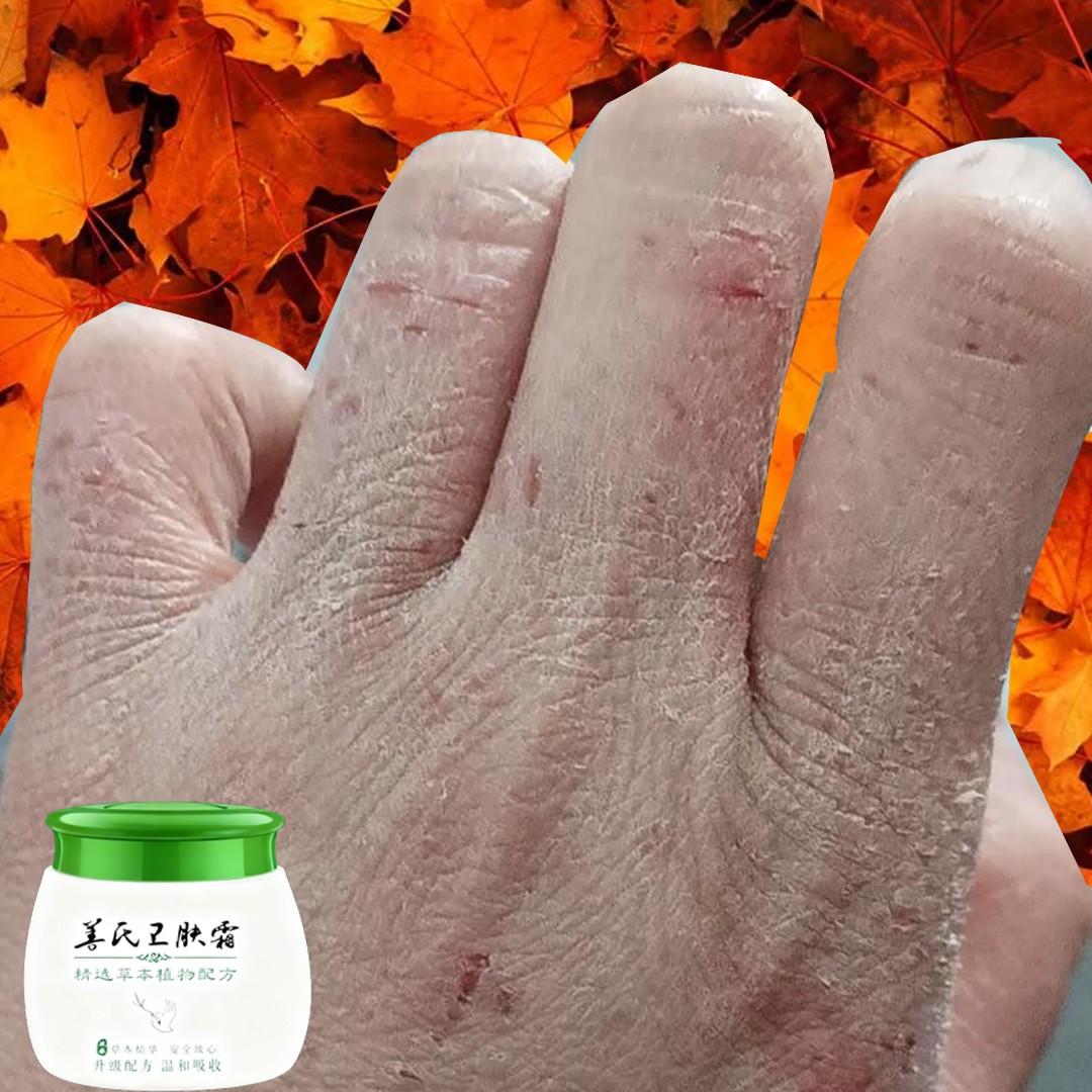 手足脱皮裂口护手膏护脚膏手脚干燥脱皮脚裂脚后跟保湿干裂防裂膏