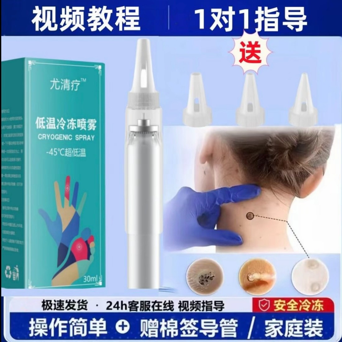 液氮冷冻喷雾低温喷雾丝状寻常扁平跖30ml一瓶