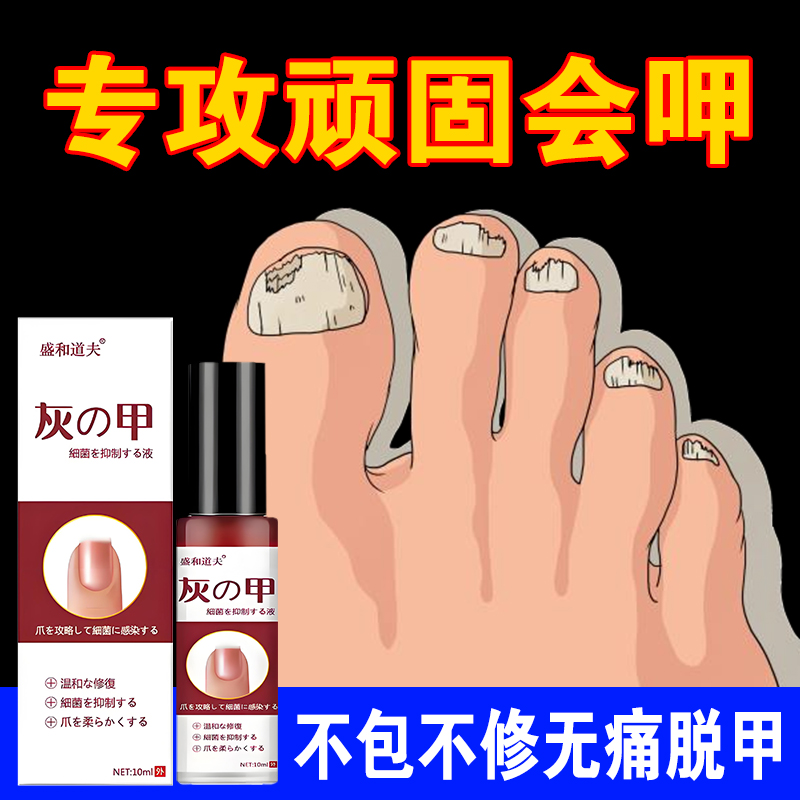 灰脚指甲趾灰甲草本抑菌液草本萃取便携外用温和涂抹修护保养修复