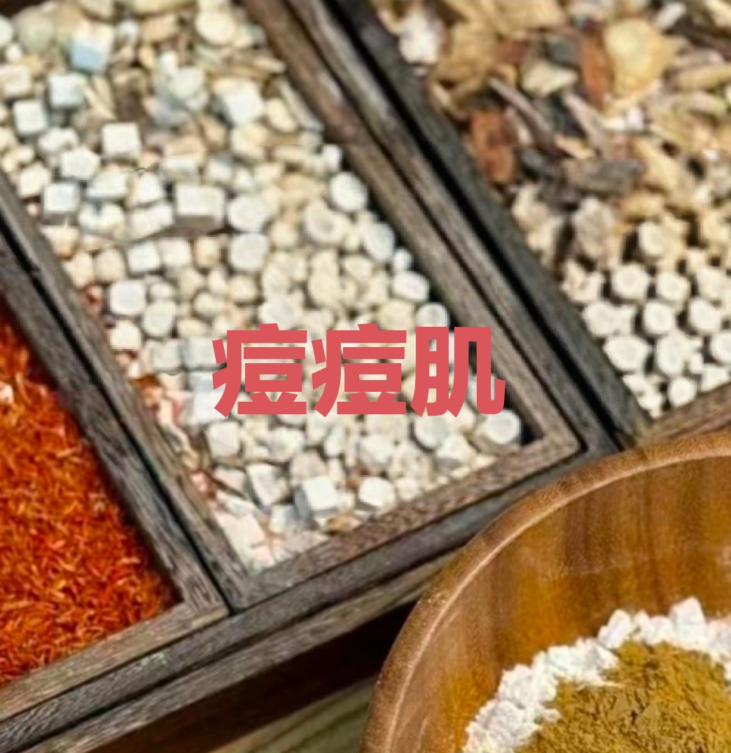 运费专拍（指导使用）草本定制清颜膜粉10次，痘痘，激素脸都可以用  