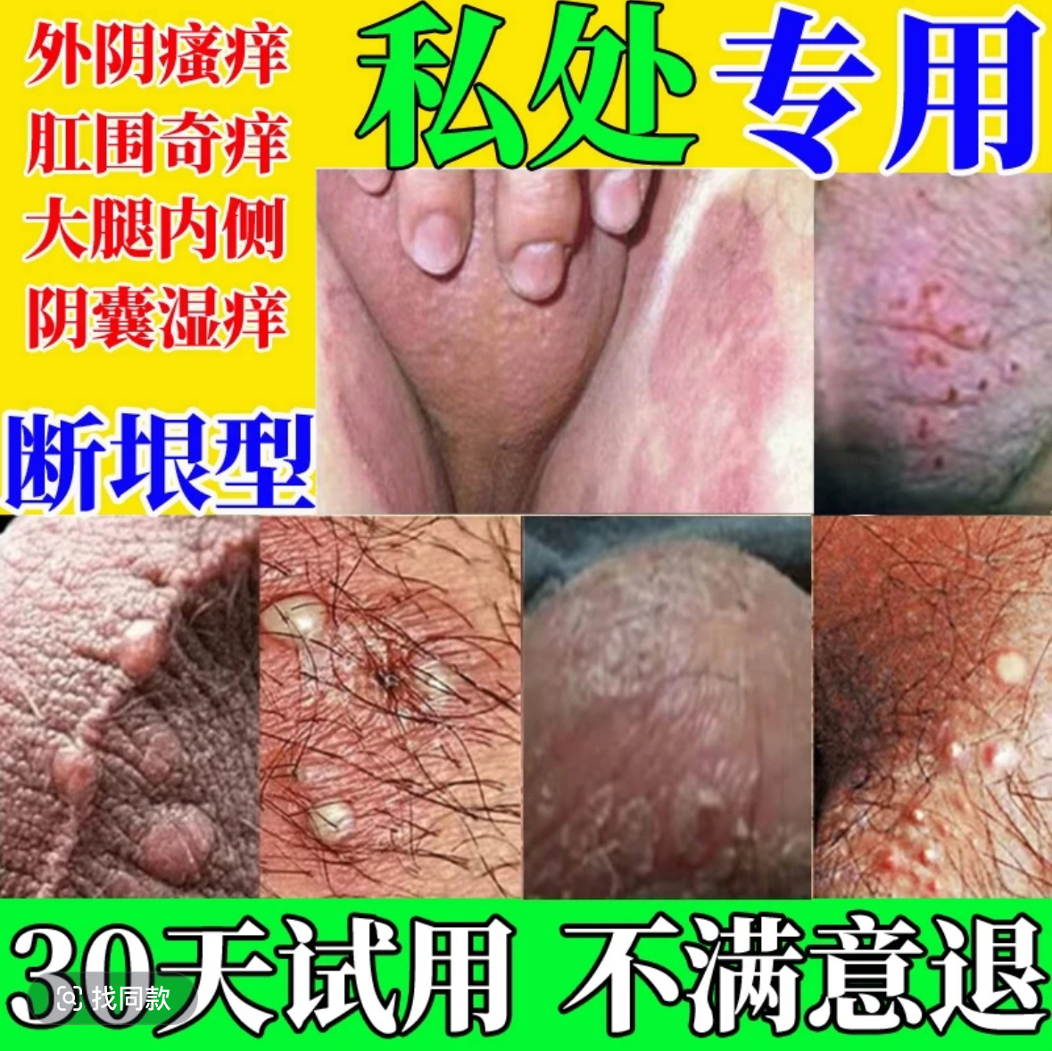 男女下体痒大腿内侧私处止痒阴囊外阴屁股肛周真菌王瘙痒抑喷剂