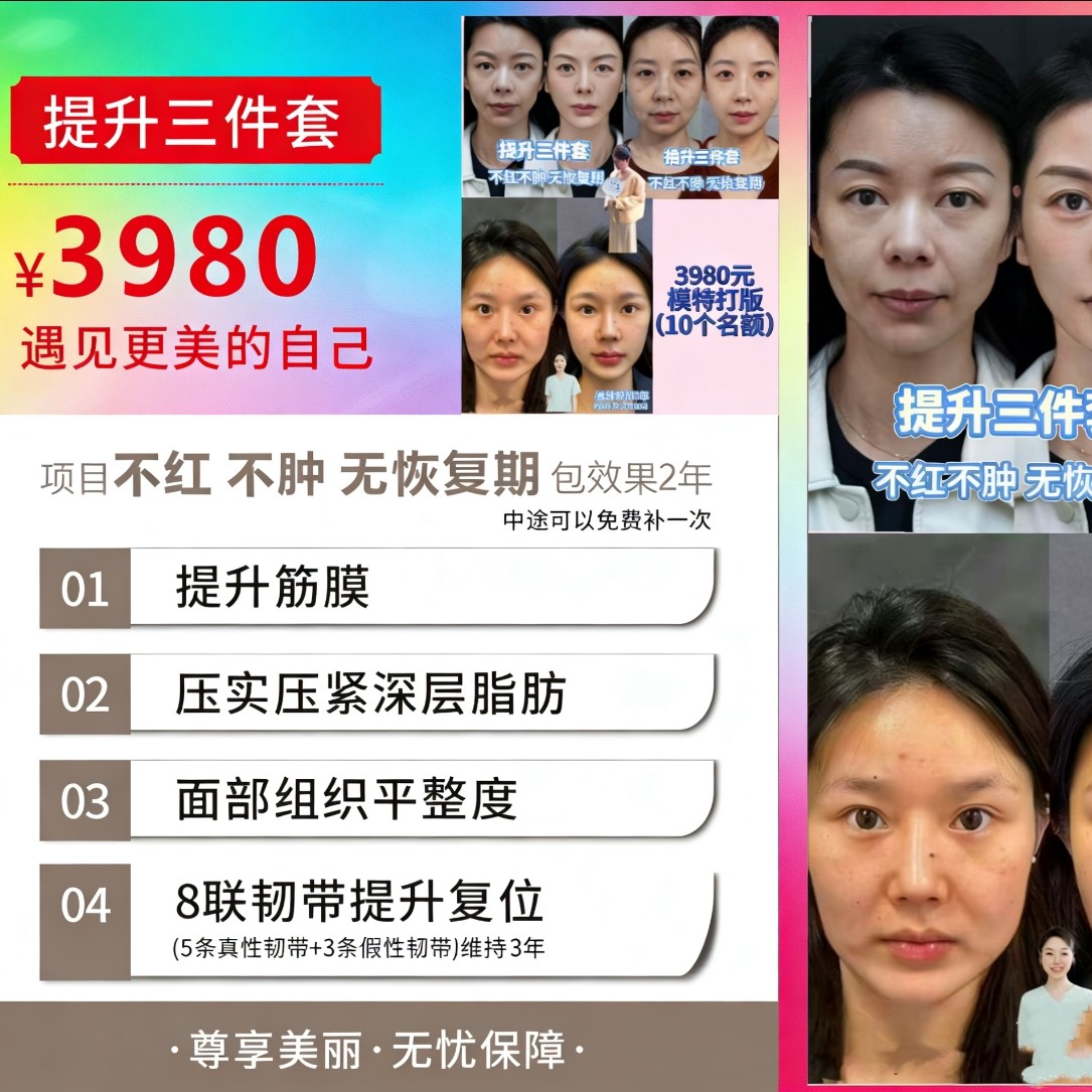 【三件套】筋膜 法令纹 口周 苹果 3年免费补