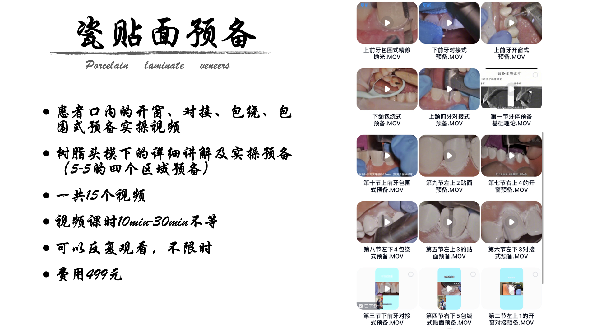 贴面预备的电子版