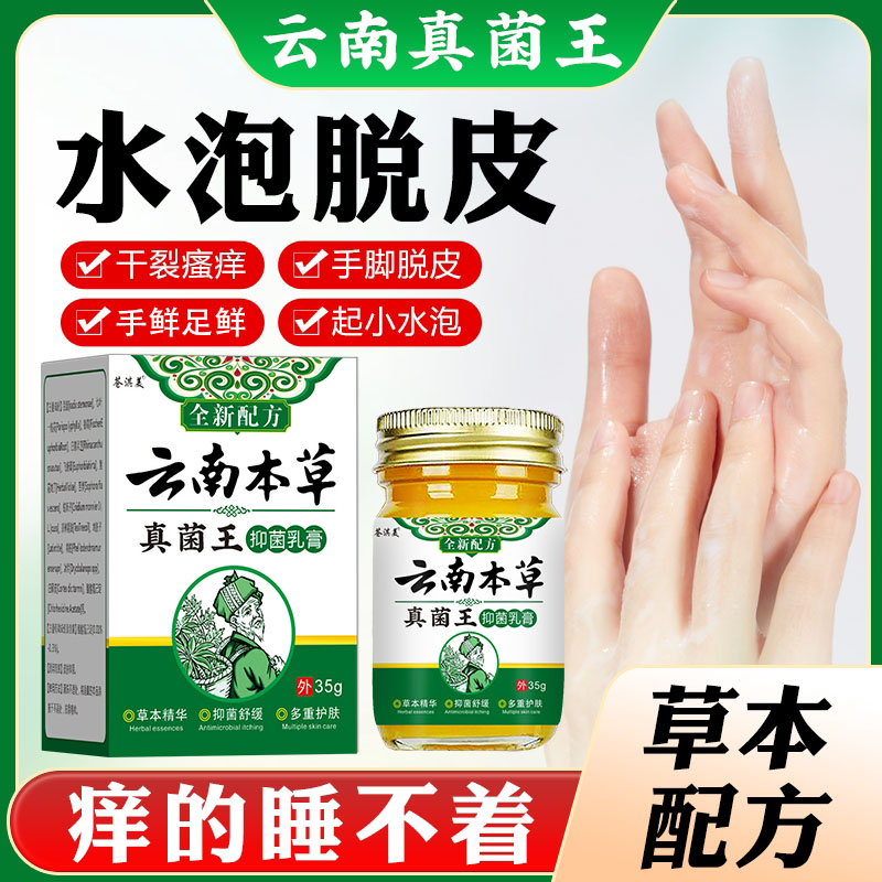 汗泡诊克星手上起小水泡止痒膏脱皮抑菌手指缝痒干裂专用草本乳膏