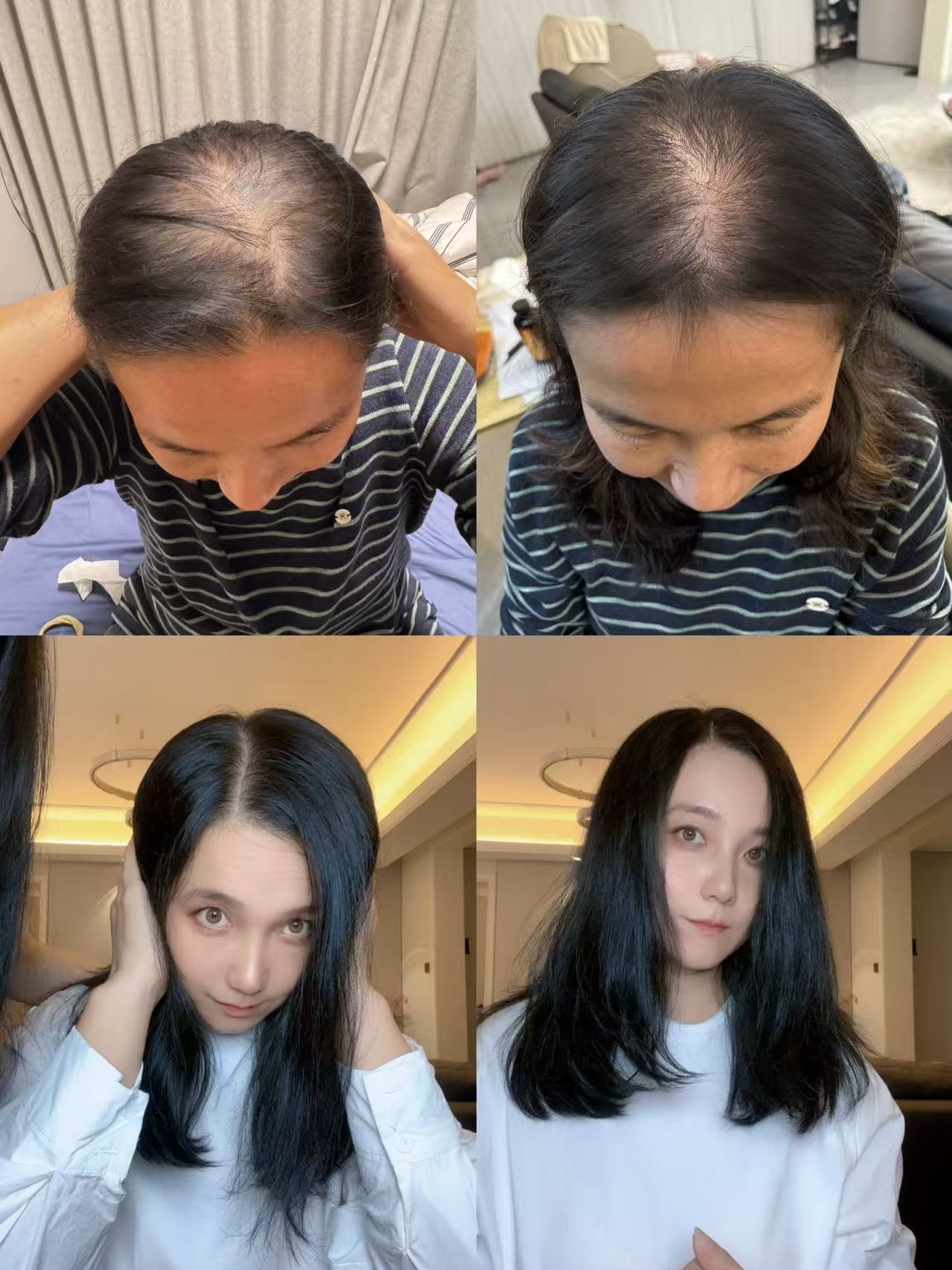 苗苗二姑姐没用精华液之前（梳子）