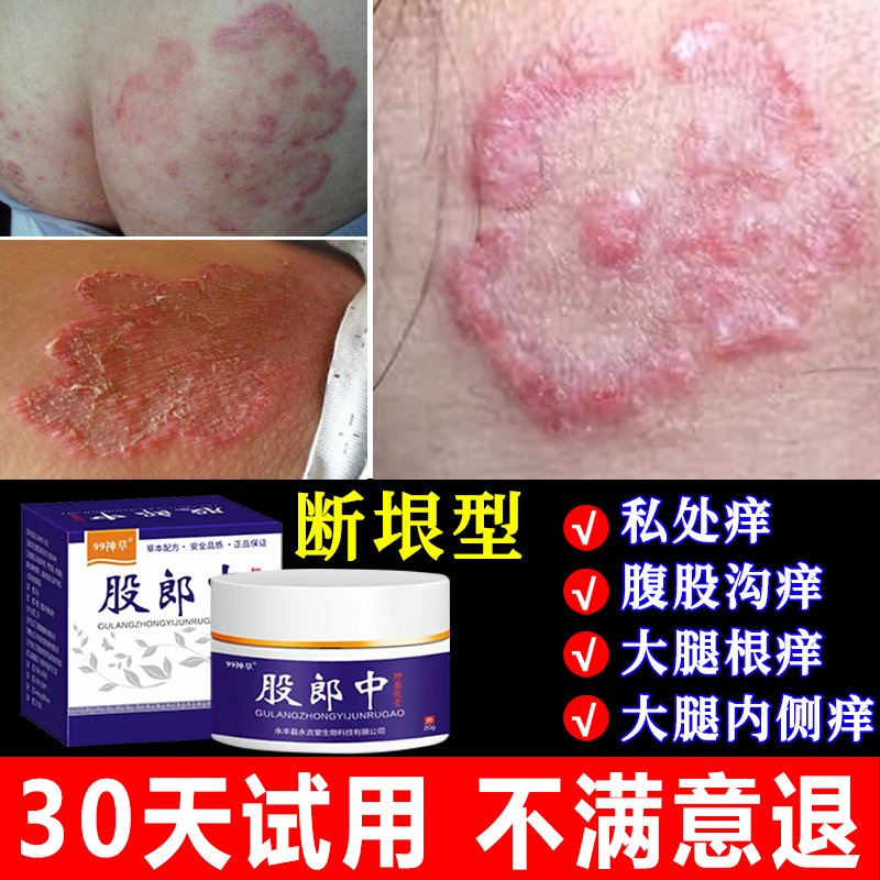 大腿根内侧两侧瘙痒止痒膏男股痒下体腹股沟痒特效抑菌乳膏专用