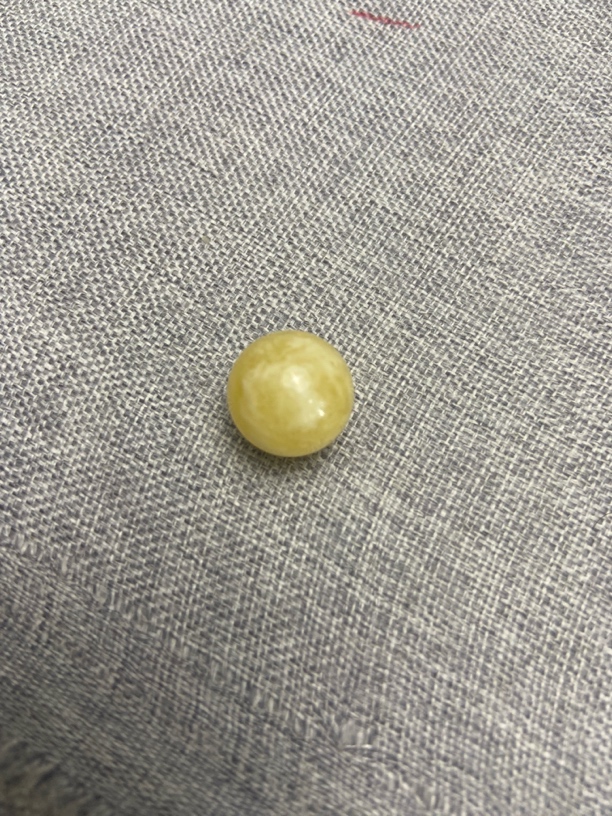 14mm单珠 蜜蜡单珠