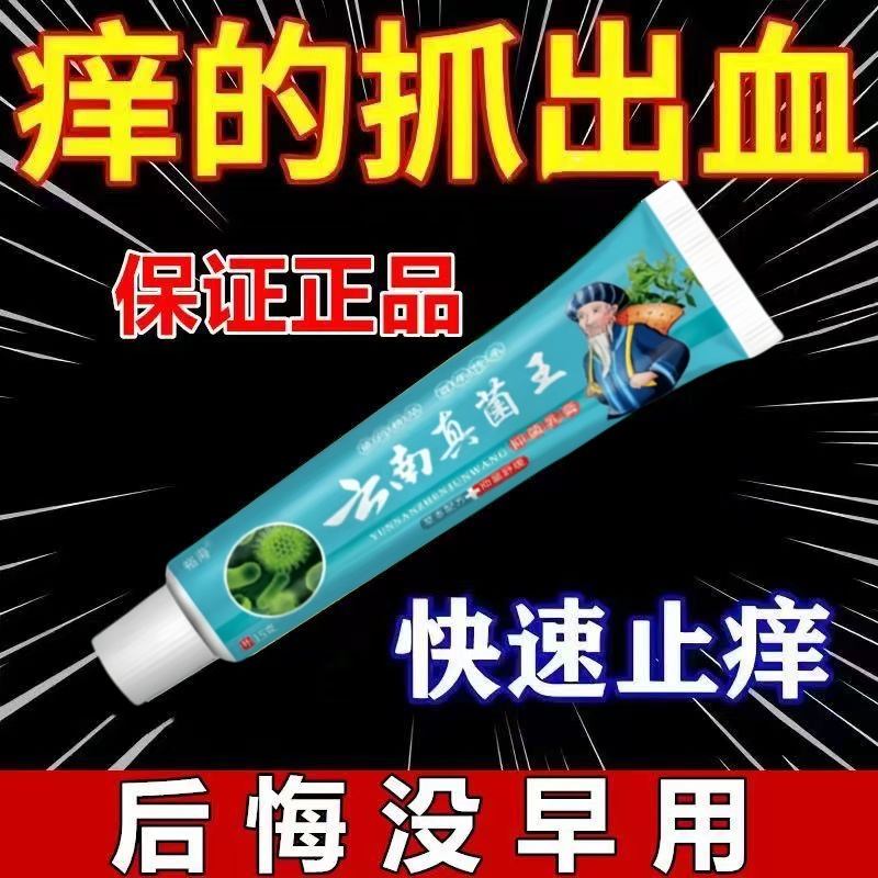 云南止痒王皮肤瘙痒止痒膏特效外用止痒乳膏蚊虫叮咬百草抑菌乳膏