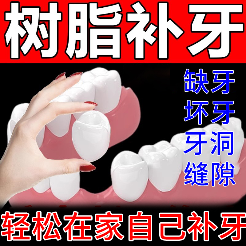 树脂牙胶自己在家临时补牙蛀牙牙洞补牙缝修复修补材料在家自己补