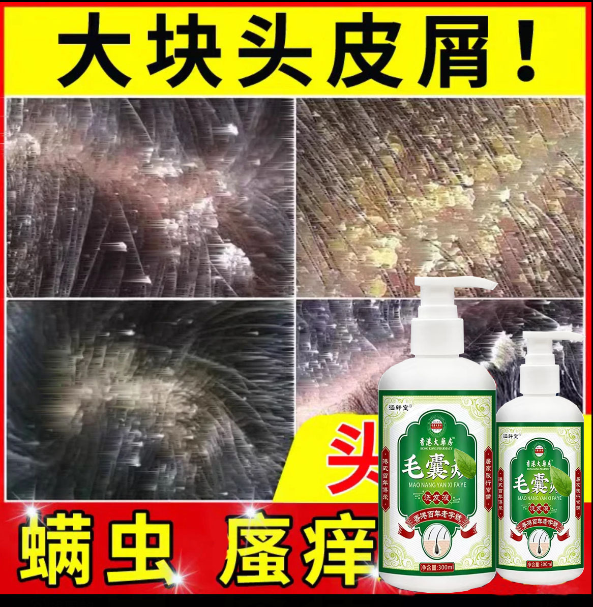 毛炎宁毛囊专用洗发水煤焦油洗剂头皮头部长红疙瘩痘痘去屑止痒