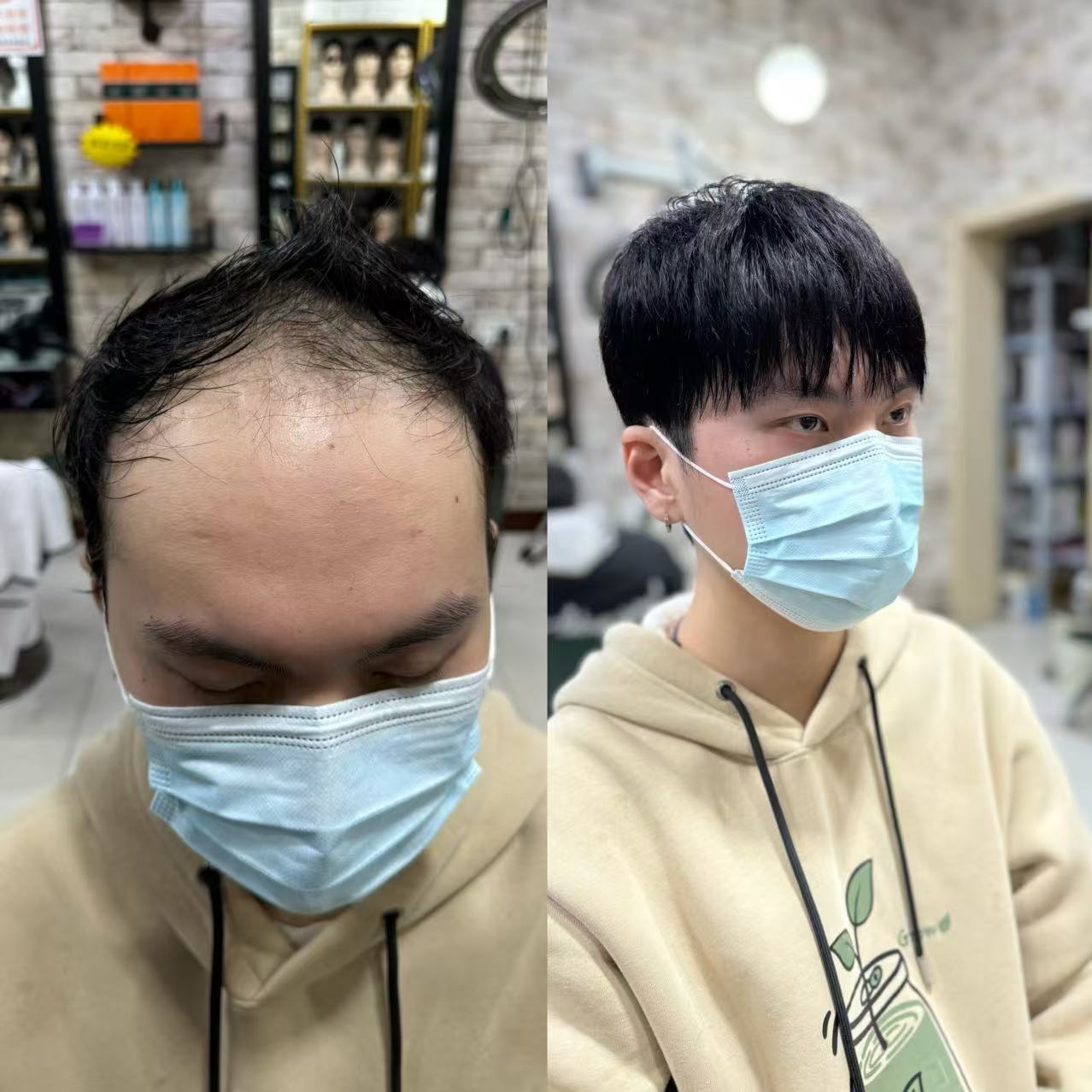假发定制必帅05款 轻薄透气 手工钩织 真人发丝 仿真头皮