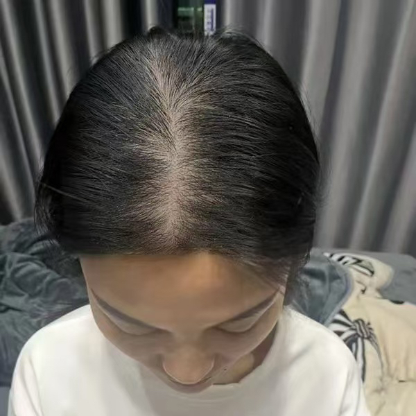 丹丹主播产后照片梳