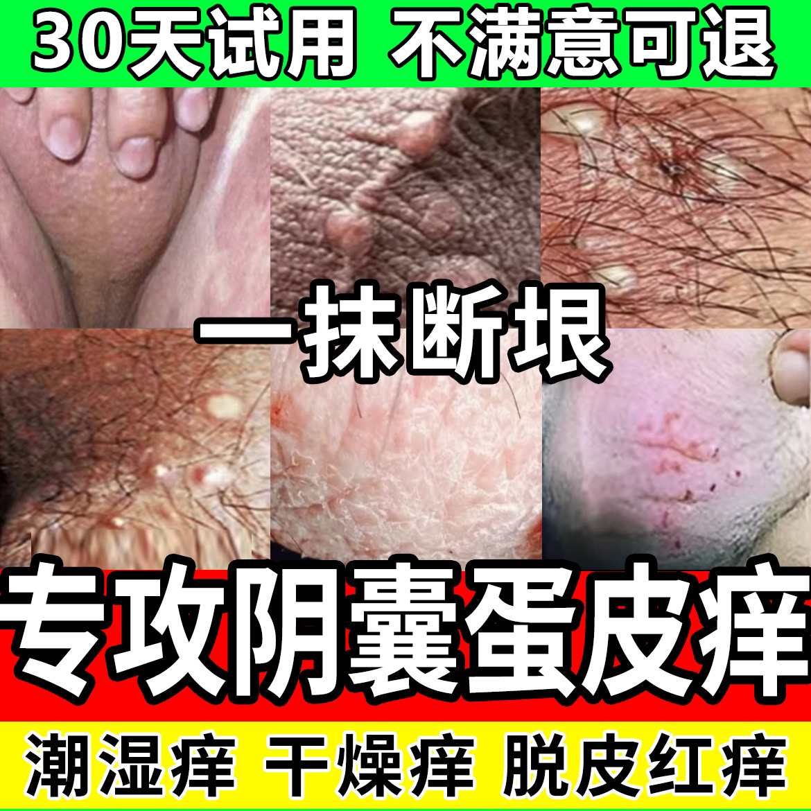 男人私处下体蛋蛋痒大腿内侧阴囊起乌龟皮疙瘩真菌王瘙痒止痒膏