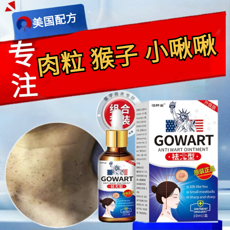 脖子小肉球身上丝状肉粒疙瘩颈部长肉球肉条身上皮赘疙瘩温和液