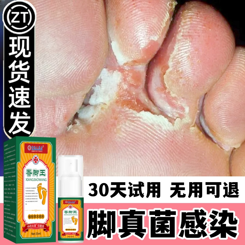 【香港大药房正品】套装香脚王脚痒脚臭外用喷剂配乳膏温和草本配方