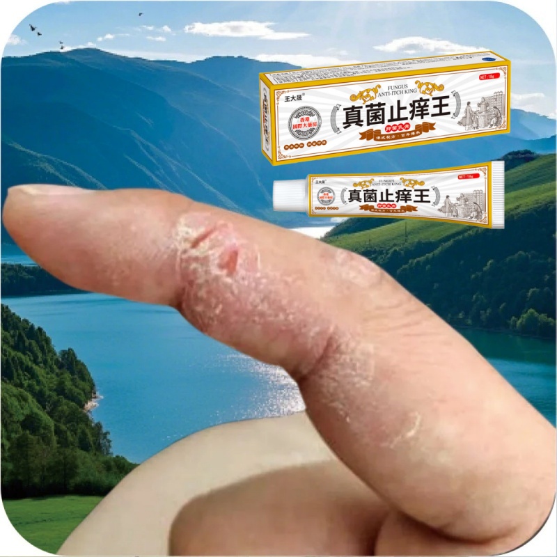 香港正品草本真菌王手指手心痒指缝痒开裂脱皮专用止痒抑菌乳膏