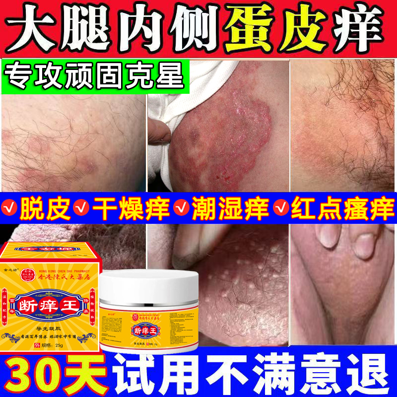 男人下体潮湿蛋皮痒专用止痒膏大腿内侧起皮红斑疙瘩抑菌止痒克星