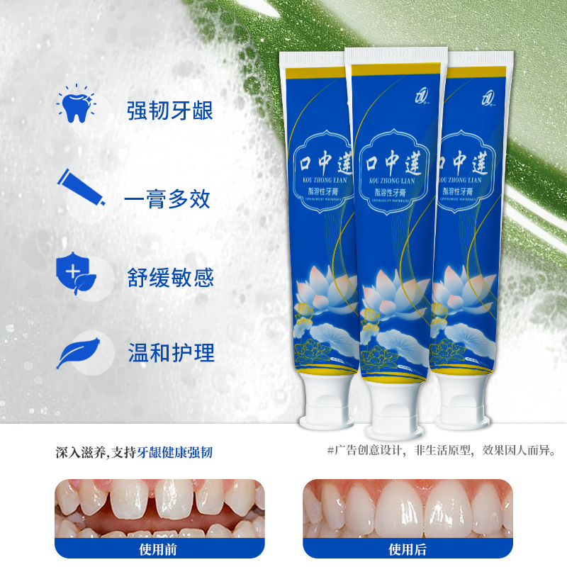 功效性牙膏口中莲脂溶性牙膏护龈深层清洁牙齿防蛀坚固口腔护理