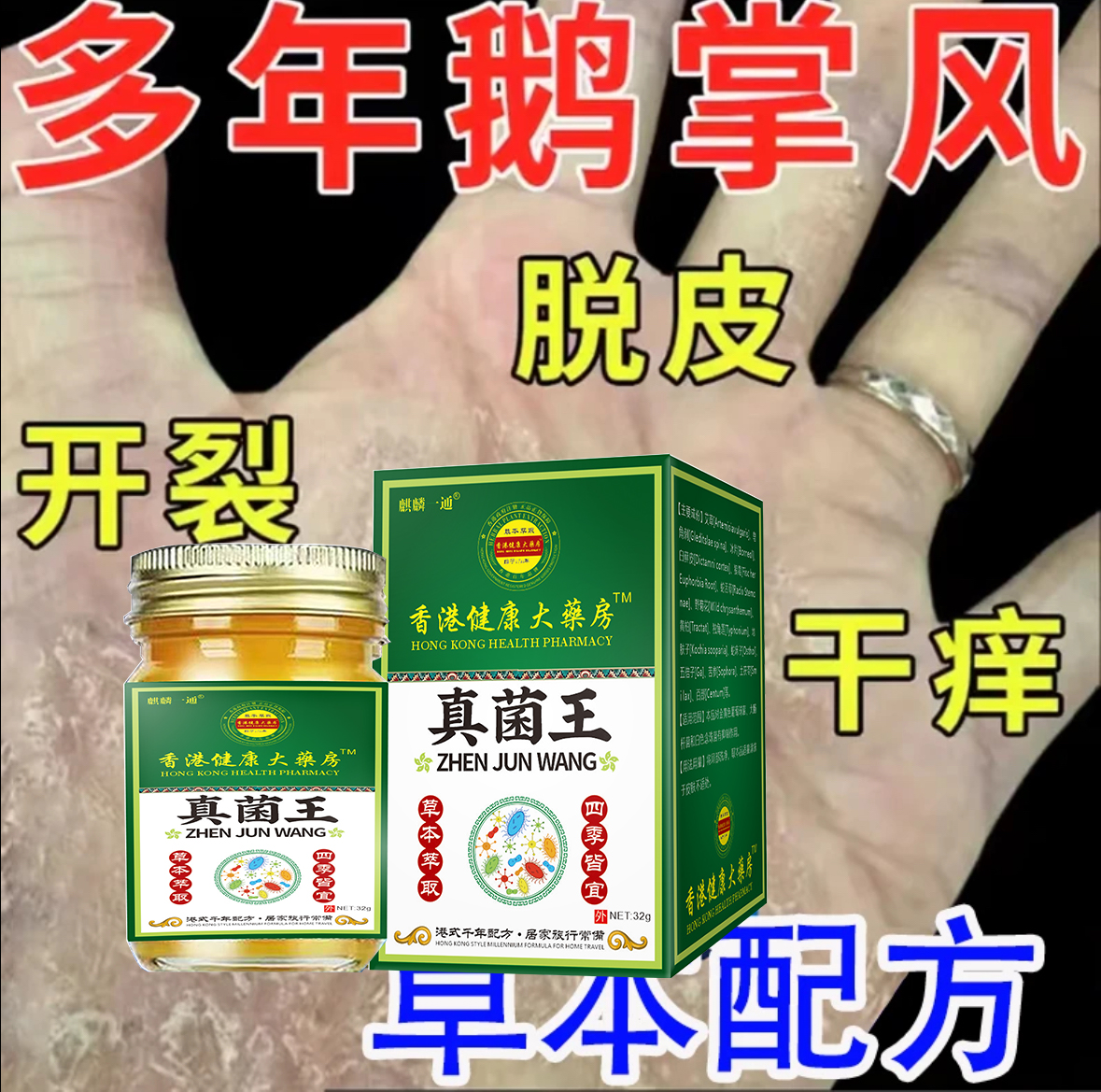 鹅掌风手足裂口脱皮发痒手上干裂脱皮止痒软膏