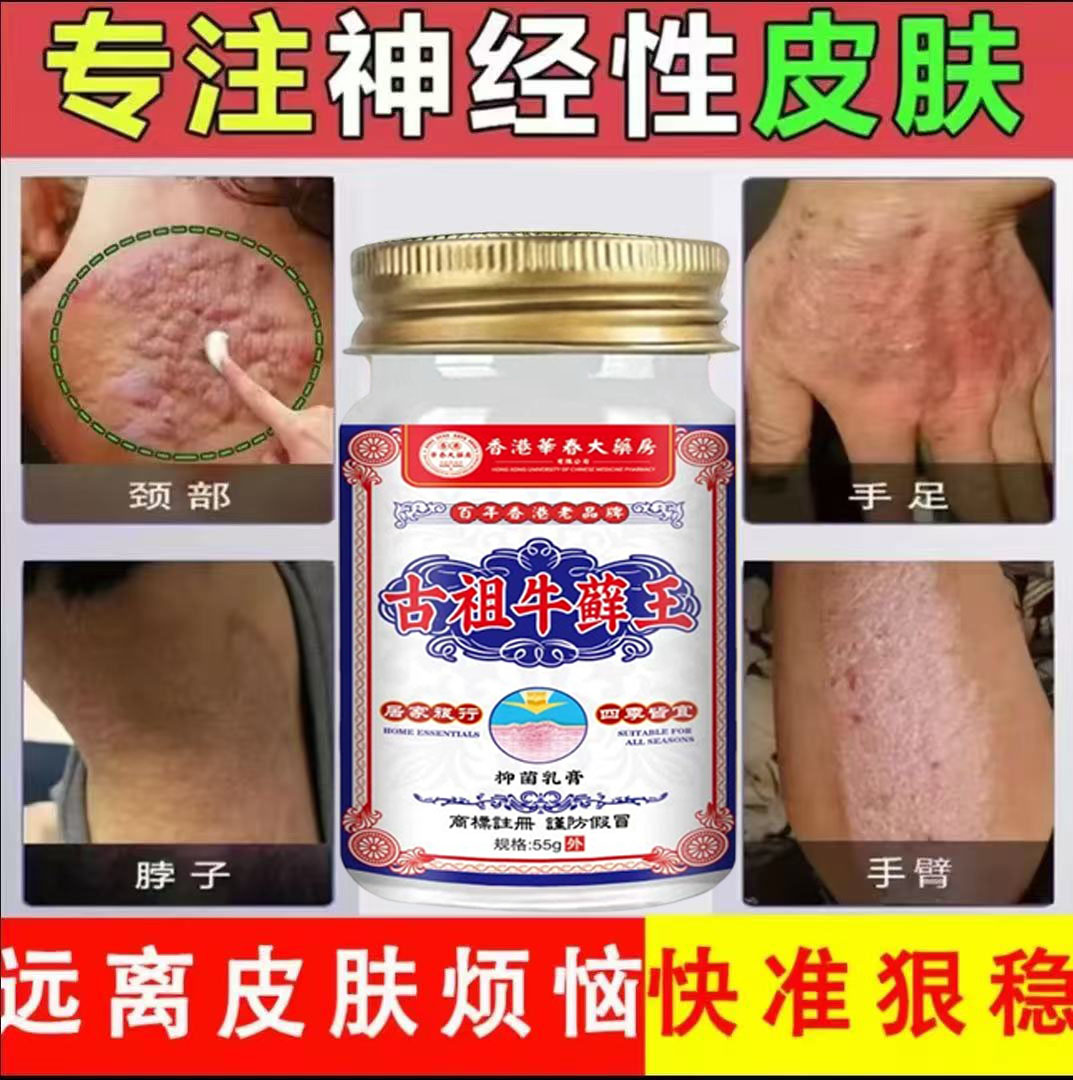 神经性皮肤外用止痒膏脂溢性日光性皮肤快速抑菌草本精华清凉乳膏