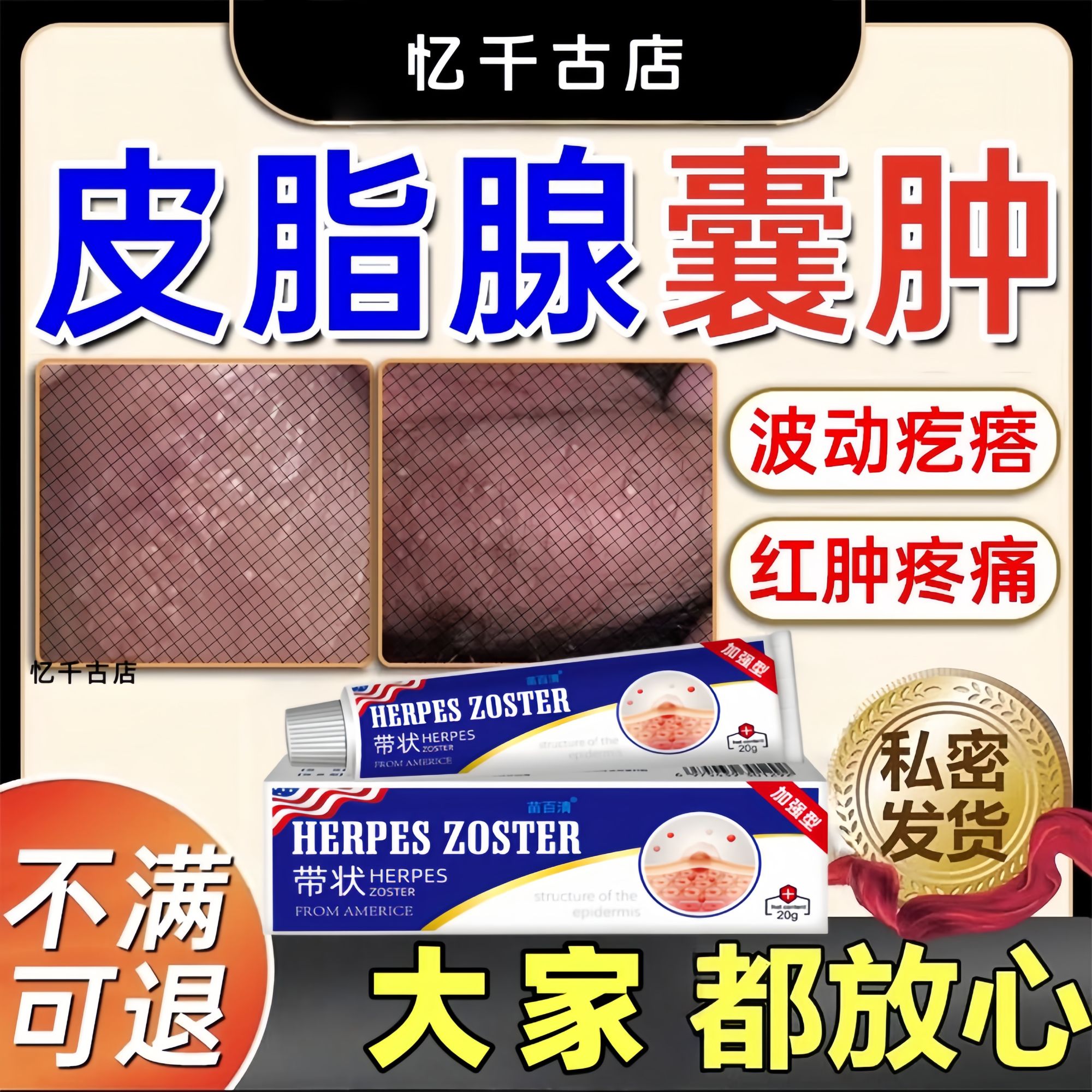 皮脂腺囊肿粉留囊专用长脂肪小颗粒疼痛止痒鼓包疖肿草本乳膏