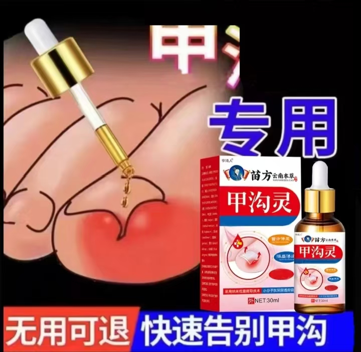 指甲长肉里甲沟软甲甲沟液护理外用草本原装修护脚部