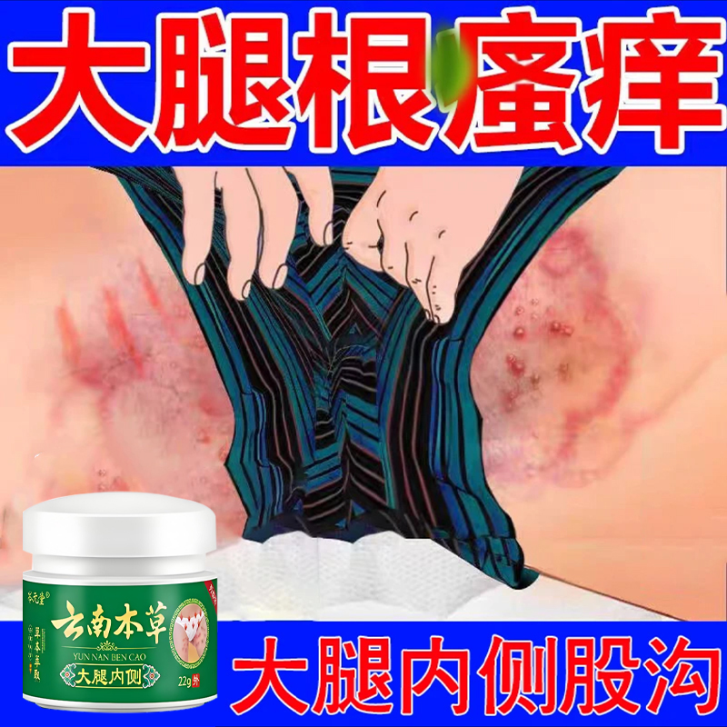 男女同款大腿内侧私处湿痒异味难闻越抓越痒全身可用草本抑菌软膏