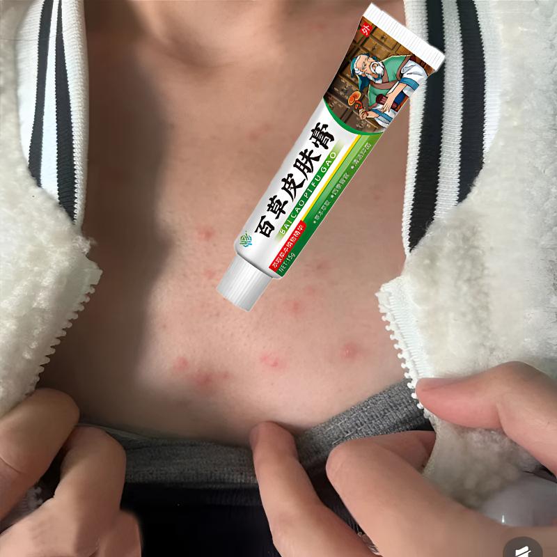 前胸后背毛囊堵塞起红点长豆豆身体长红疙瘩毛囊豆止痒草本护理膏