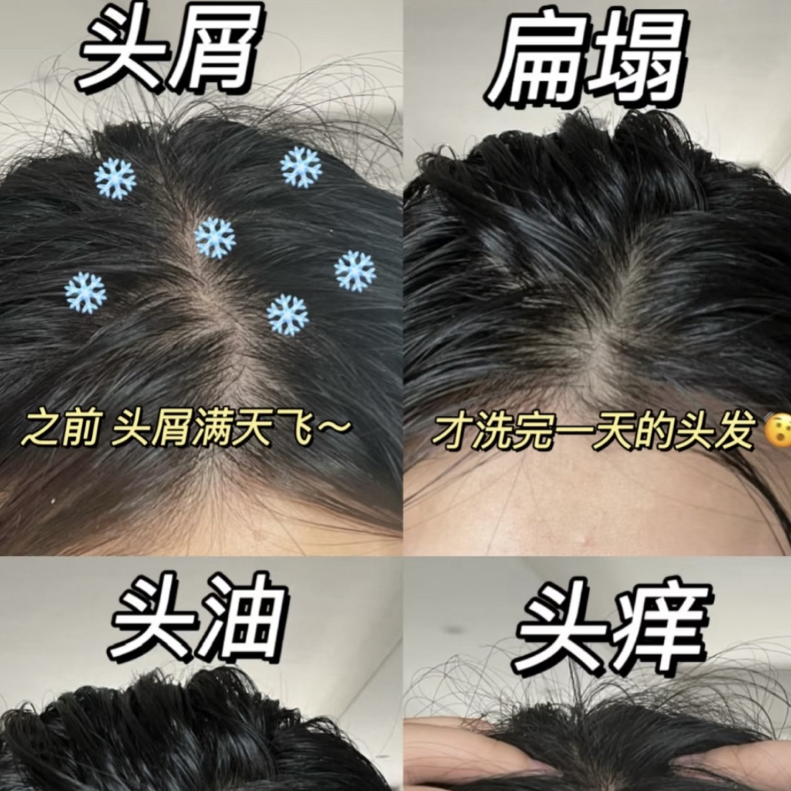 洗发水试用装专拍去屑止痒控油蓬松小红点柔顺滋养