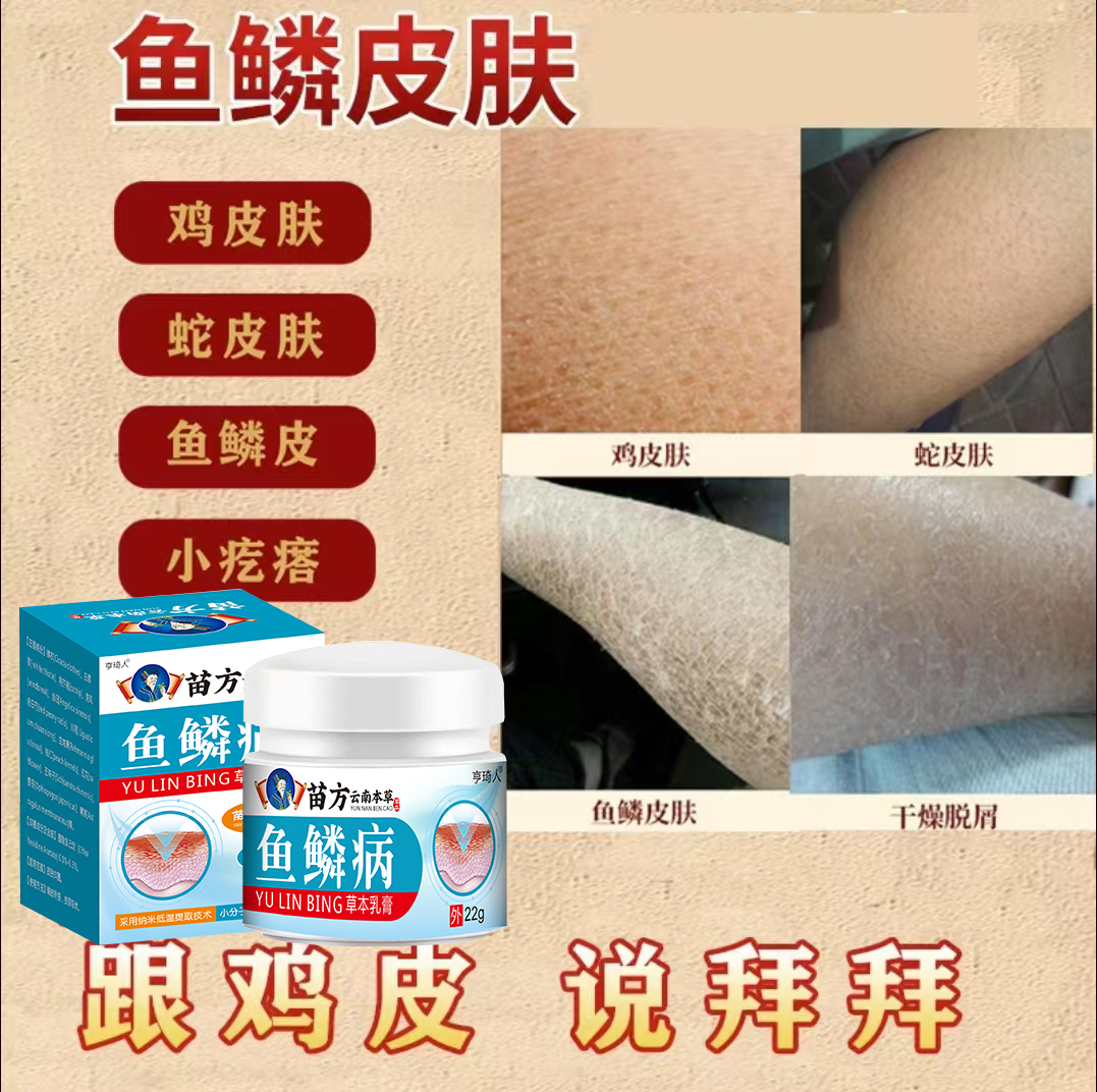 鱼鳞皮鸡皮去除疙瘩毛囊角化大腿手臂毛孔堵塞皮肤干燥粗糙专用膏