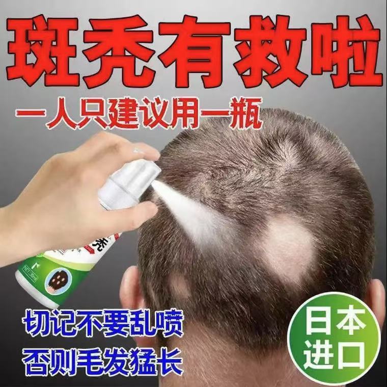 鬼剃头专用喷剂严重突发性掉头发斑秃脂溢性皮焱防脱生发身体护理