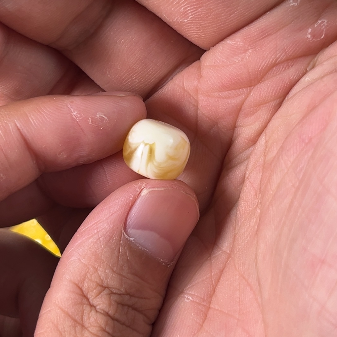 琥珀裸石未镶嵌汤*蜜蜡金白老型12加