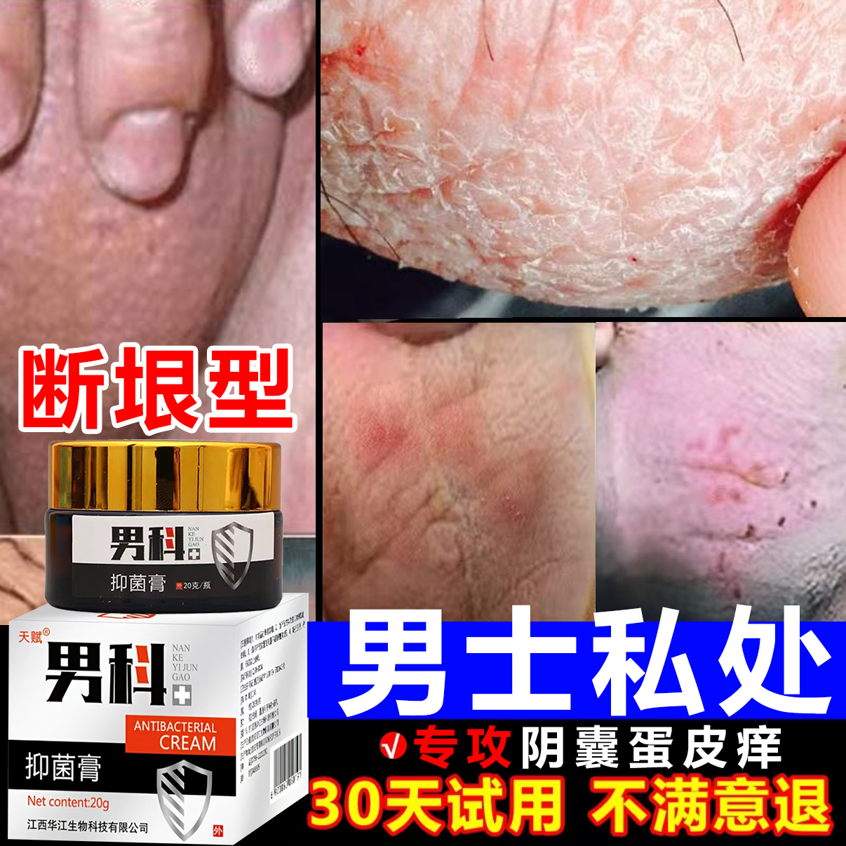 男人私处蛋蛋痒阴囊下体湿痒大腿内侧痒起乌龟皮疙瘩痒抑菌止痒膏