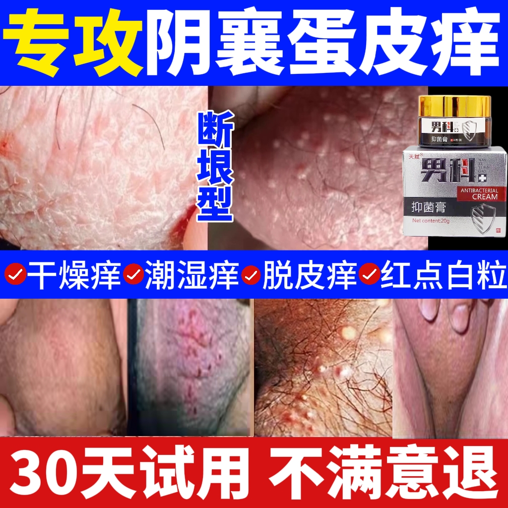 男人私处蛋蛋痒阴处潮湿下体大腿内侧痒起乌龟疙瘩皮痒抑菌止痒膏