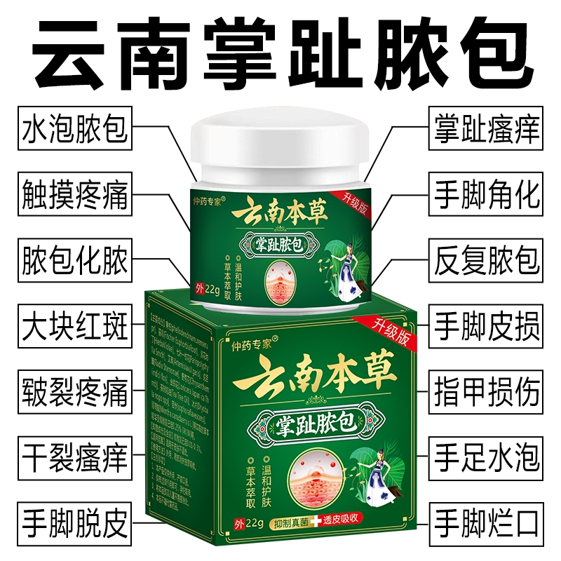 掌跖脓包病膏掌趾脓包手足脓包病脚脓泡脱皮干裂掌跖角化症