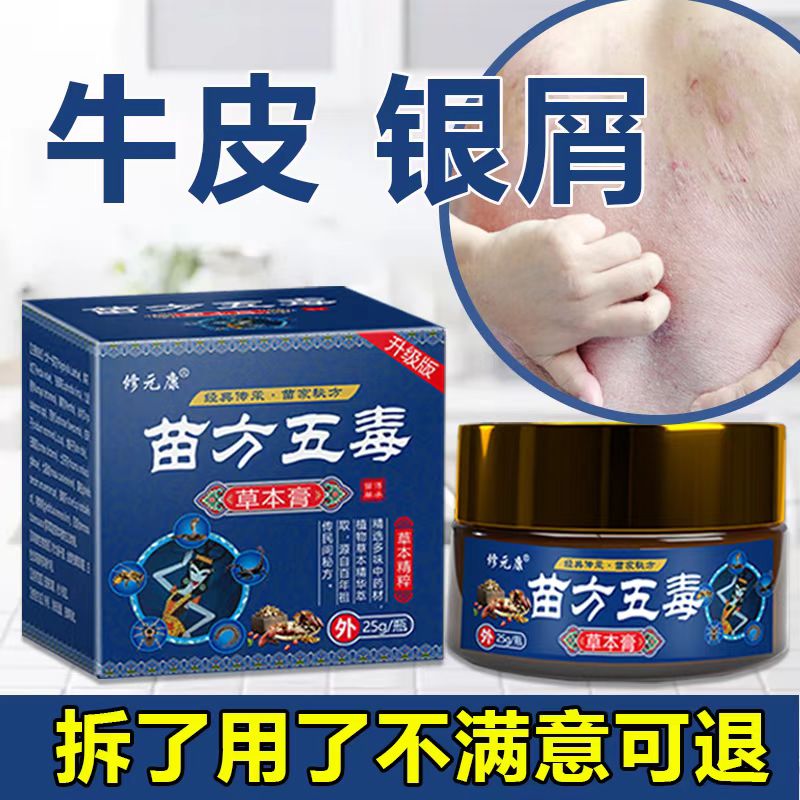 牛、皮专用皮肤顽固银、王痒皮肤脱、屑手足越抓越痒抑菌蚊虫止痒膏