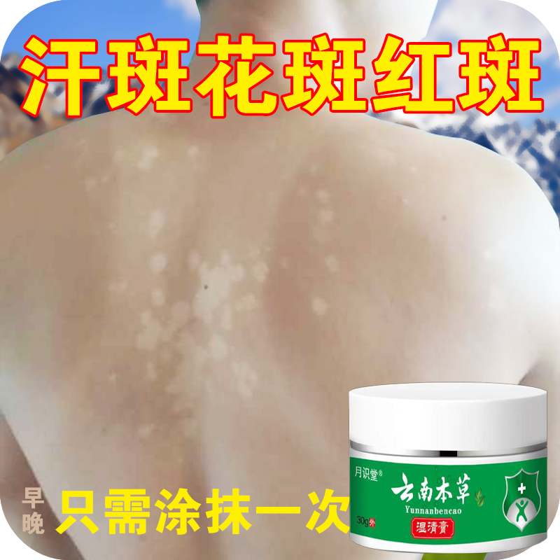 汗斑外用汗斑净去花斑专用膏前胸后背全身腋下正品草本抑菌乳膏