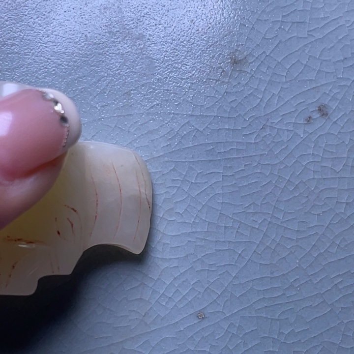 君***玉瓷片瓷器瓷器瓷器瓷器瓷器