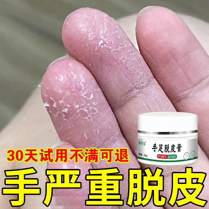 手足脱皮干裂霜严重鹅掌风手脚脱皮痒修复裂口真菌感染专用软乳膏