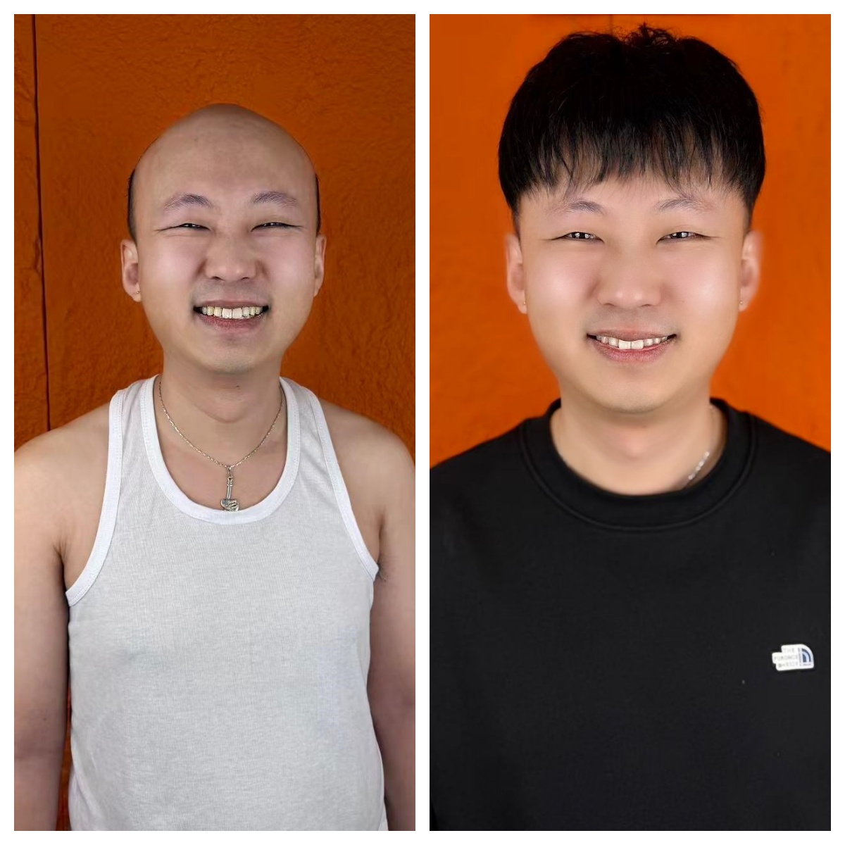 生物薄边真人仿真发际线全真发男士假发100%真人发丝