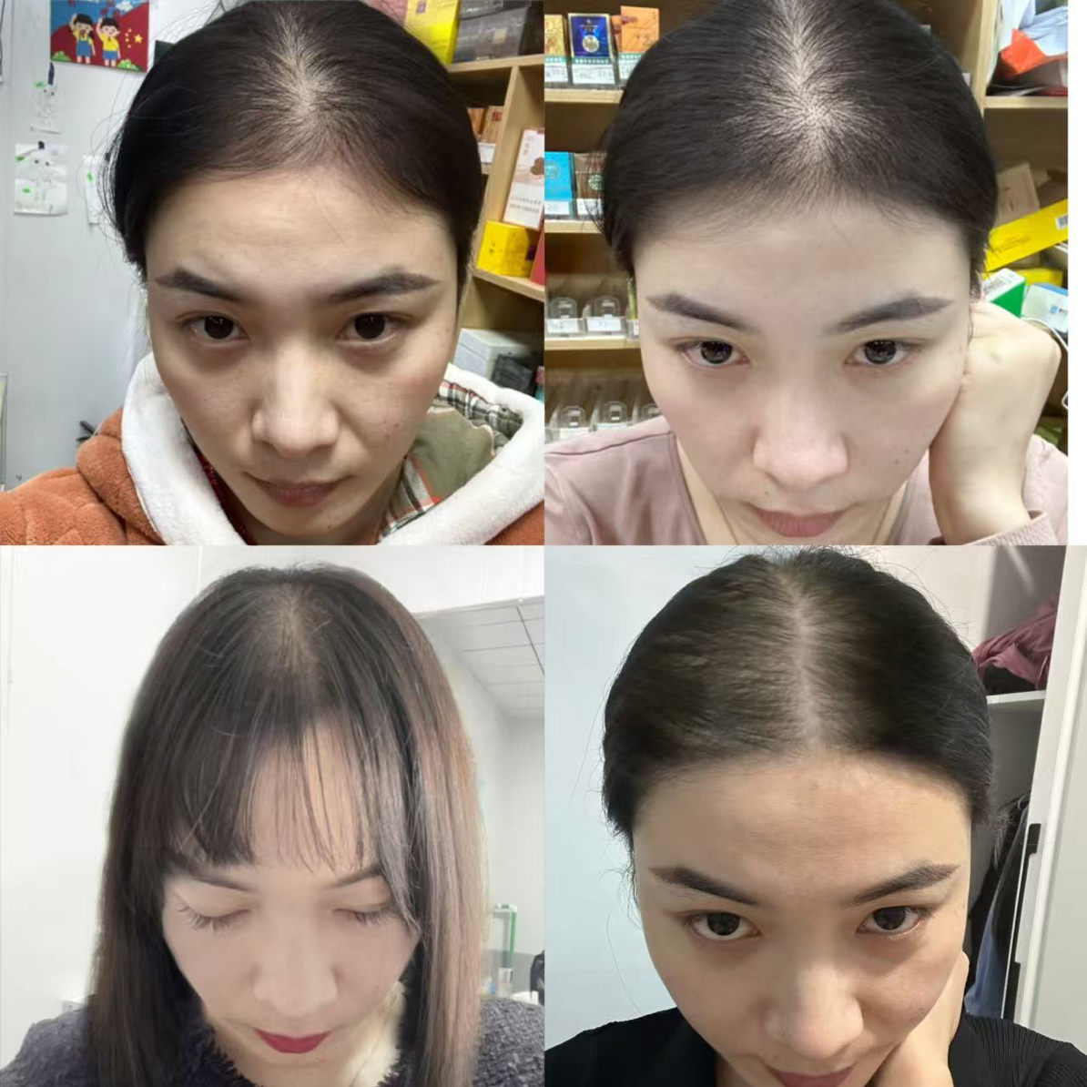 苗苗之前的照片（气垫梳子）
