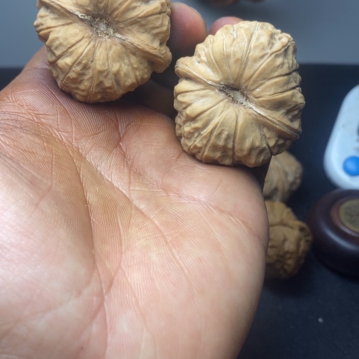 骨质密度绝对没问题